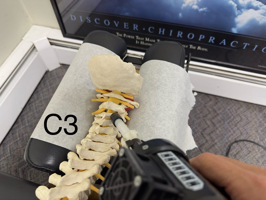 Linwood chiropractor shows where you adjust the C3 bone to relieve trigeminal neuralgia.