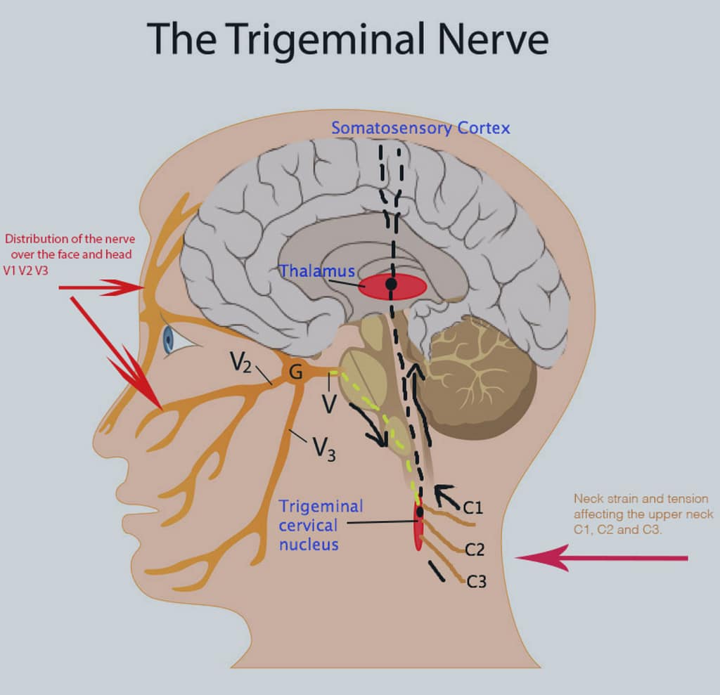 Linwood Chiropractor explains how C3 nerves impact trigeminal neuralgia.