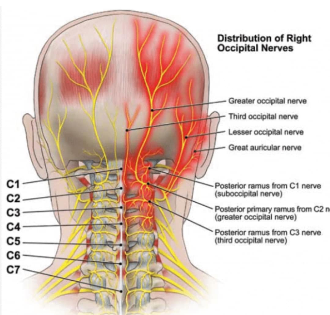 Occipital Neuralgia explained by Linwood Chiropractor