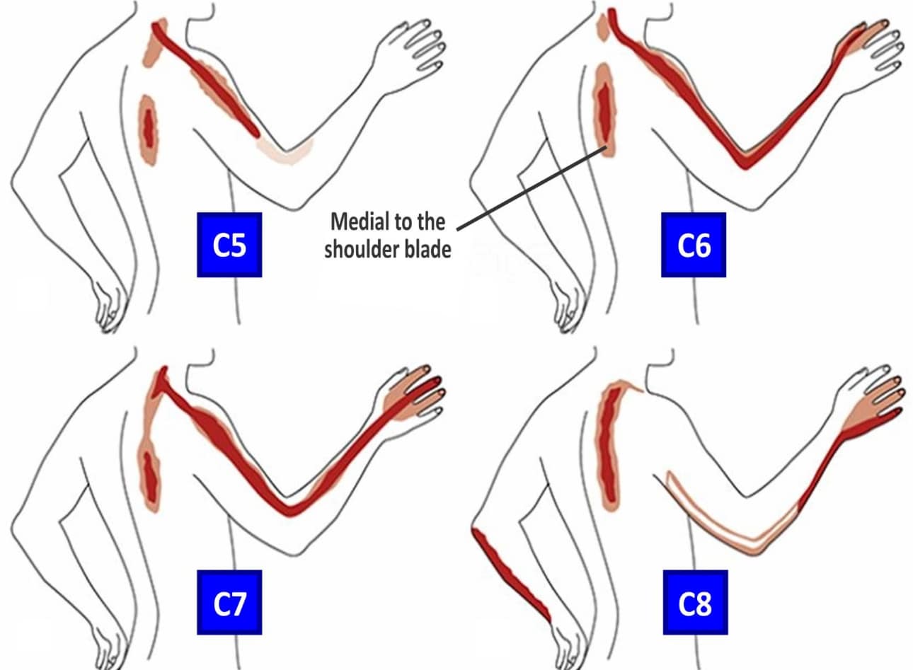 C7 nerve pain pathway