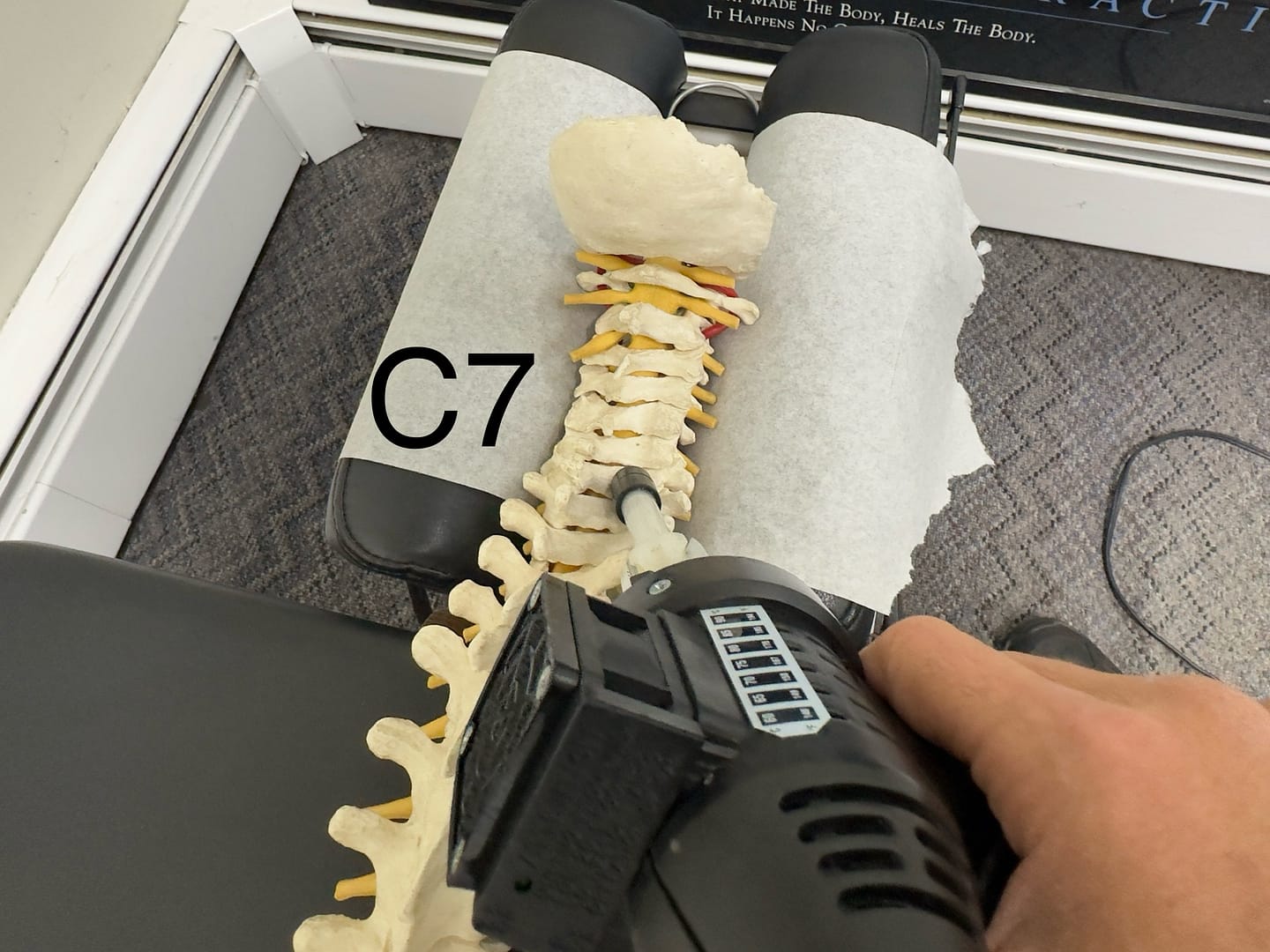 Linwood chiropractor show where to adjust the cervical spine for pain relief